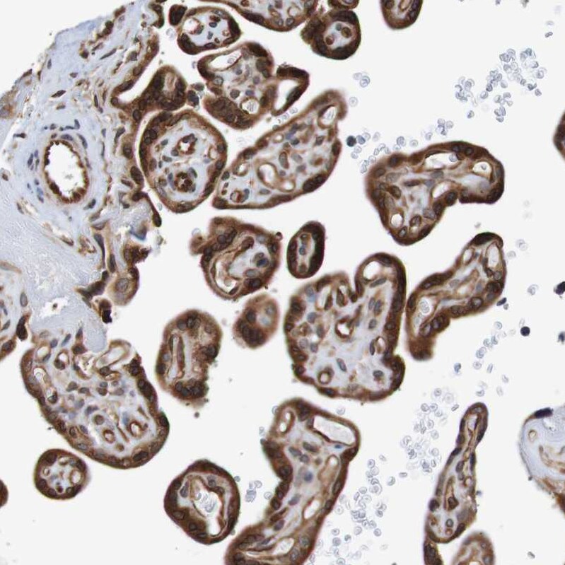 TMEM109 Antibody - BSA Free Immunohistochemistry: TMEM109 Antibody - BSA Free [NBP1-93462]