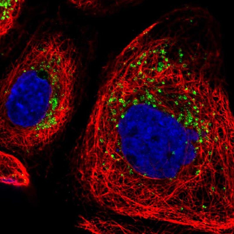 DRAM2 Antibody - BSA Free Immunocytochemistry/ Immunofluorescence: DRAM2 Antibody [NBP1-93463]