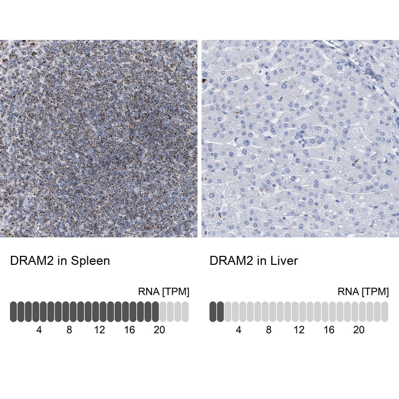 DRAM2 Antibody - BSA Free Immunohistochemistry: DRAM2 Antibody - BSA Free [NBP1-93463]