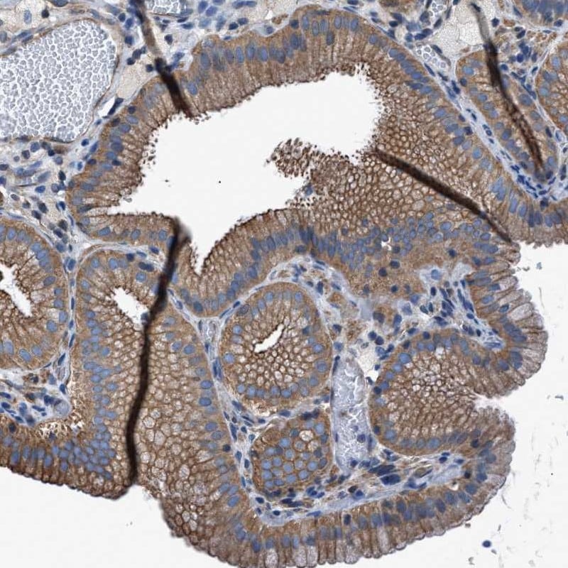 TMEM261 Antibody - BSA Free Immunohistochemistry: TMEM261 Antibody - BSA Free [NBP1-93465]
