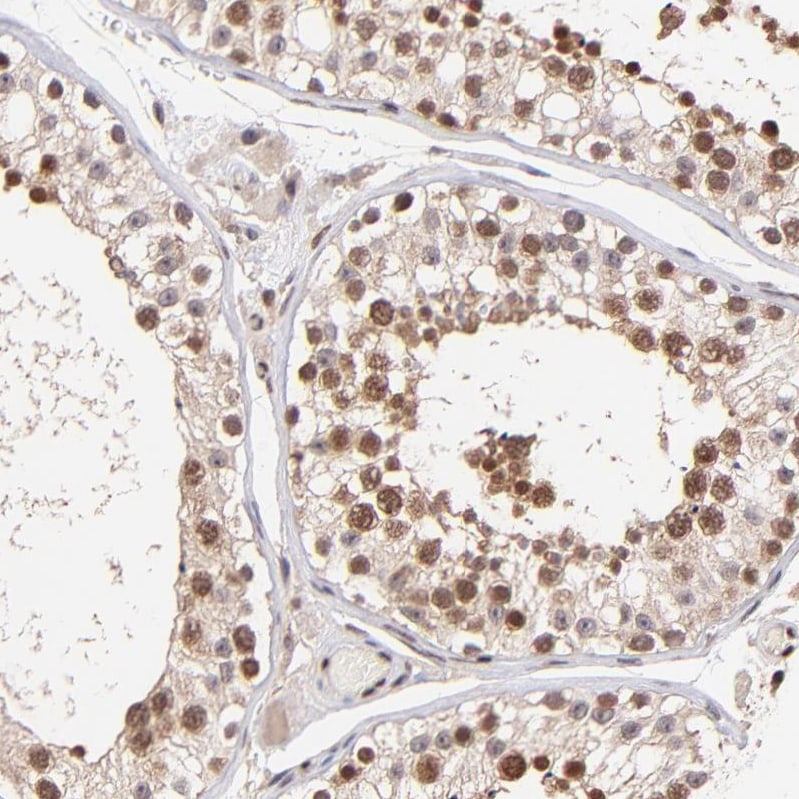 WDR25 Antibody - BSA Free Immunohistochemistry: WDR25 Antibody - BSA Free [NBP1-93467]