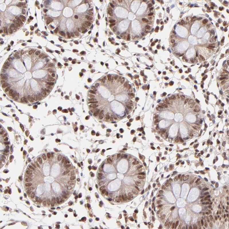 WDR25 Antibody - BSA Free Immunohistochemistry: WDR25 Antibody - BSA Free [NBP1-93467]