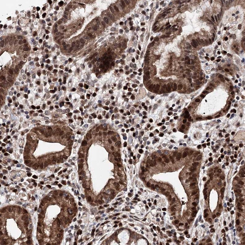 C12orf45 Antibody - BSA Free Immunohistochemistry-Paraffin: C12orf45 Antibody [NBP1-93474]
