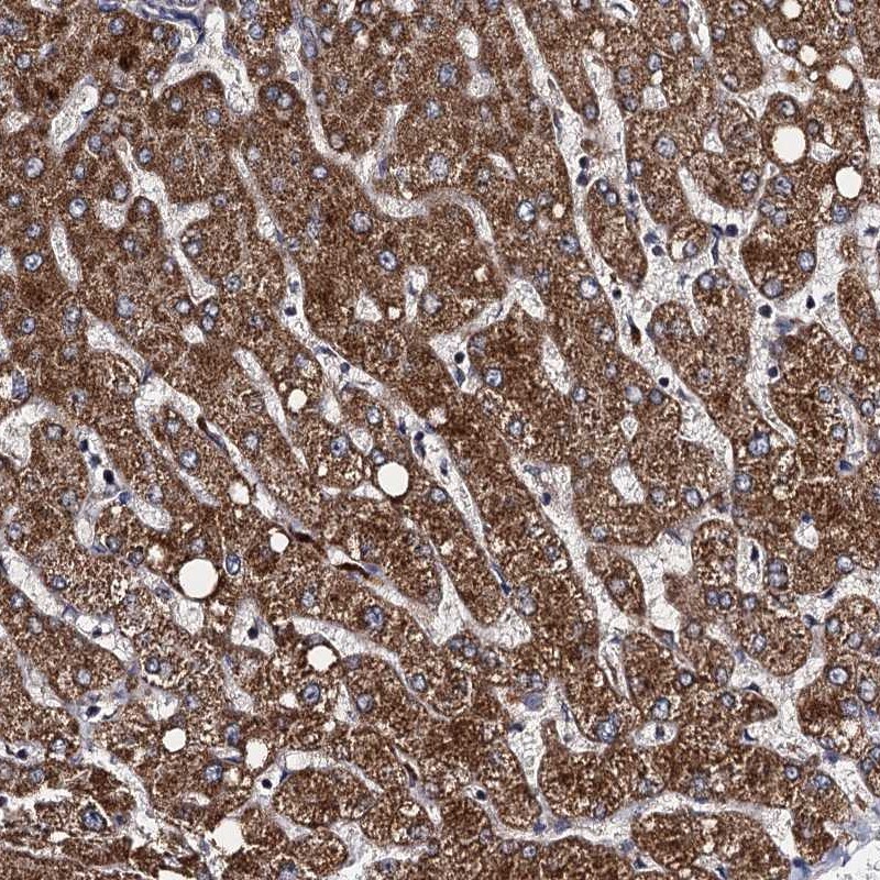 VPS37D Antibody - BSA Free Immunohistochemistry-Paraffin: VPS37D Antibody [NBP1-93480]