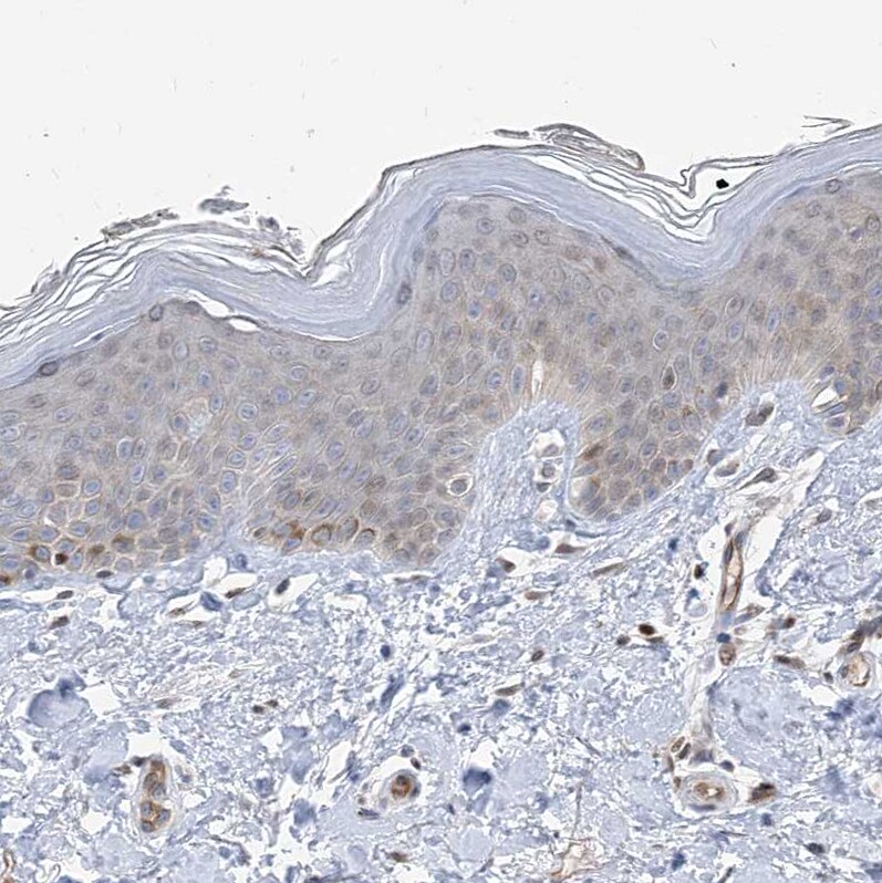 TYSND1 Antibody - BSA Free Immunohistochemistry: TYSND1 Antibody - BSA Free [NBP1-93484]
