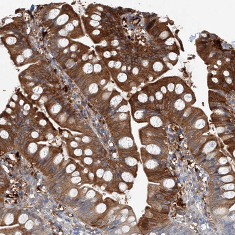 ARMH1 Antibody - BSA Free Immunohistochemistry: ARMH1 Antibody - BSA Free [NBP1-93486]