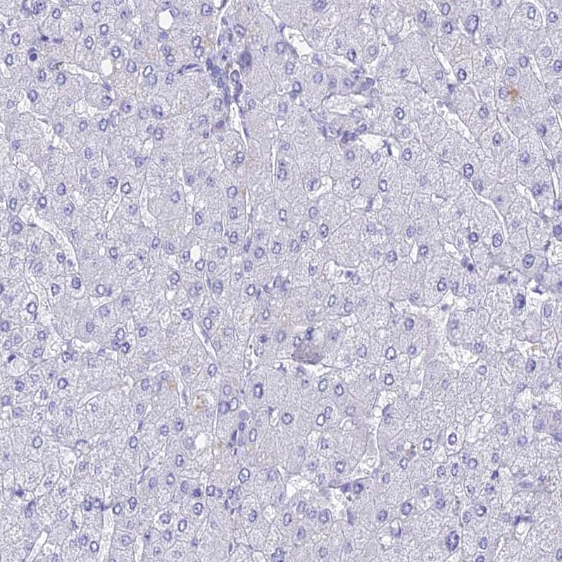 TMEM161B Antibody - BSA Free Immunohistochemistry: TMEM161B Antibody - BSA Free [NBP1-93488]