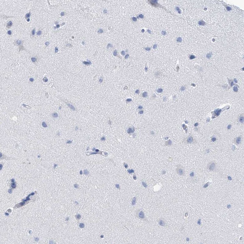 NCU-G1 Antibody - BSA Free Immunohistochemistry: NCU-G1 Antibody - BSA Free [NBP1-93491]