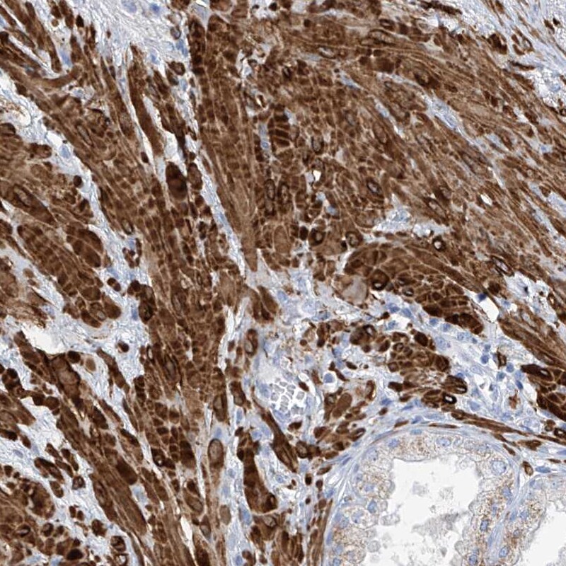 NCU-G1 Antibody - BSA Free Immunohistochemistry: NCU-G1 Antibody - BSA Free [NBP1-93491]