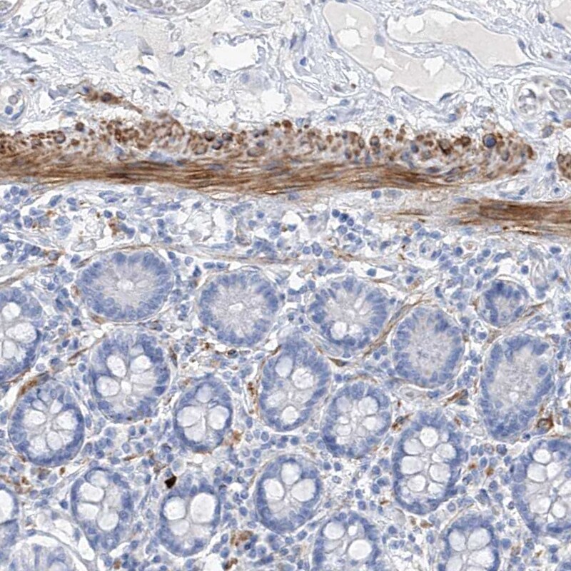 NCU-G1 Antibody - BSA Free Immunohistochemistry: NCU-G1 Antibody - BSA Free [NBP1-93491]