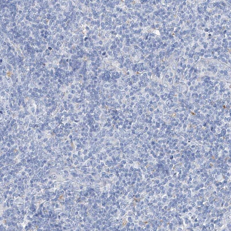 NCU-G1 Antibody - BSA Free Immunohistochemistry: NCU-G1 Antibody - BSA Free [NBP1-93491]