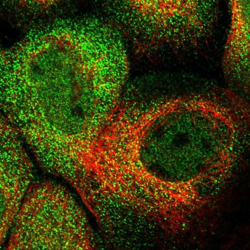 HROB Antibody - BSA Free Immunocytochemistry/ Immunofluorescence: HROB Antibody [NBP1-93493]