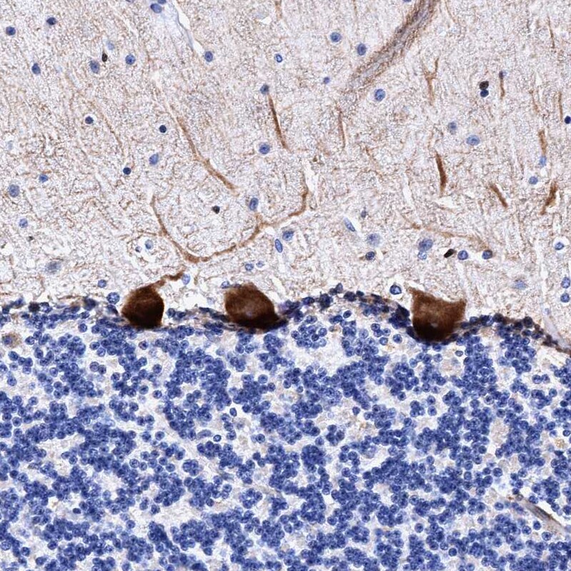 FAM100B Antibody - BSA Free Immunohistochemistry: FAM100B Antibody - BSA Free [NBP1-93496]