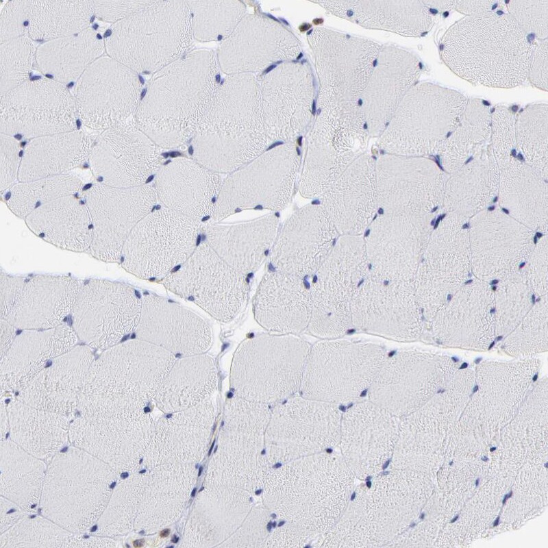 MOSPD2 Antibody - BSA Free Immunohistochemistry: MOSPD2 Antibody - BSA Free [NBP1-93499]