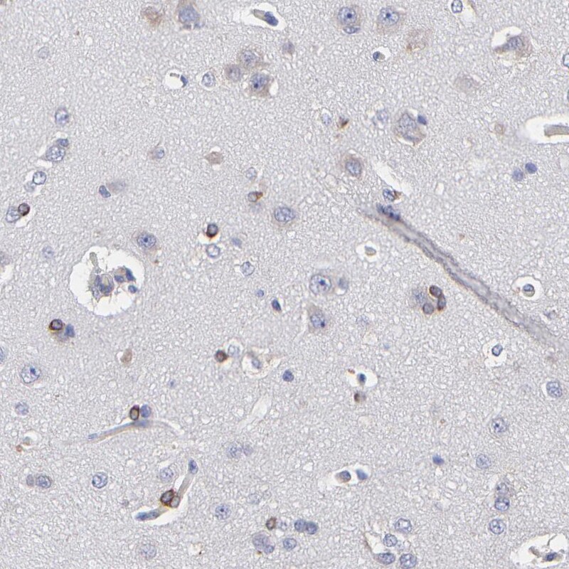 MOSPD2 Antibody - BSA Free Immunohistochemistry: MOSPD2 Antibody - BSA Free [NBP1-93499]