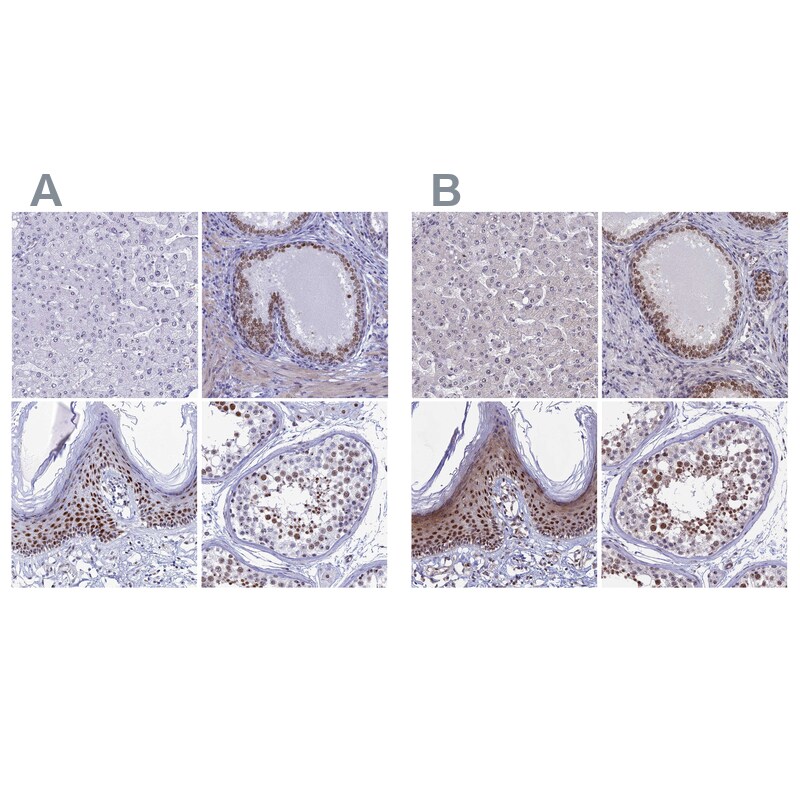CCDC86 Antibody - BSA Free Immunohistochemistry: CCDC86 Antibody - BSA Free [NBP1-93500]
