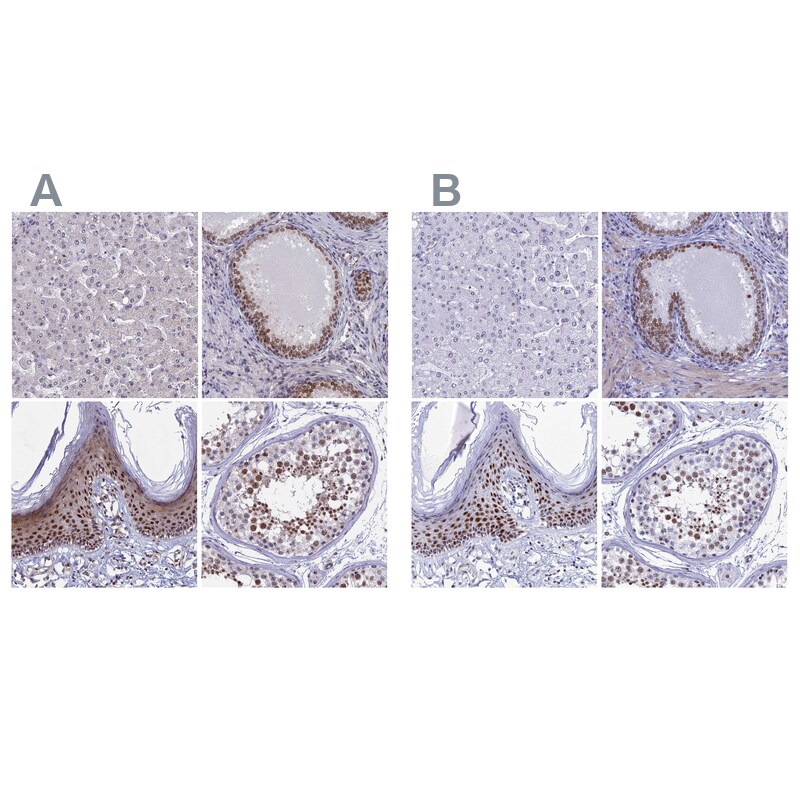 CCDC86 Antibody - BSA Free Immunohistochemistry-Paraffin: CCDC86 Antibody [NBP1-93501]