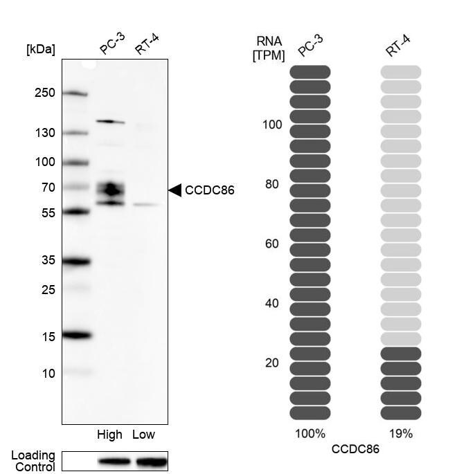 CCDC86 Antibody - BSA Free Western Blot: CCDC86 Antibody - BSA Free [NBP1-93501]