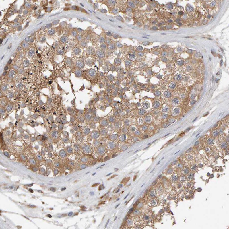 C9orf72 Antibody - BSA Free Immunohistochemistry: C9orf72 Antibody - BSA Free [NBP1-93504]