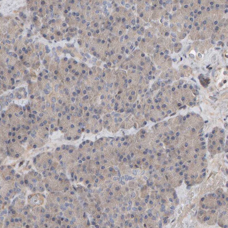 C9orf72 Antibody - BSA Free Immunohistochemistry: C9orf72 Antibody - BSA Free [NBP1-93504]