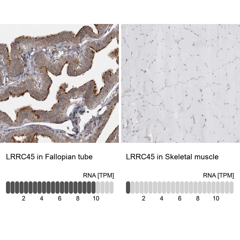 LRRC45 Antibody - BSA Free Immunohistochemistry: LRRC45 Antibody - BSA Free [NBP1-93508]
