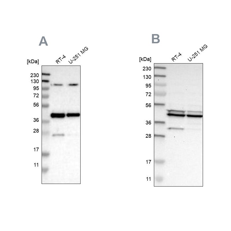 CCDC104 Antibody - BSA Free Western Blot: CCDC104 Antibody - BSA Free [NBP1-93514]