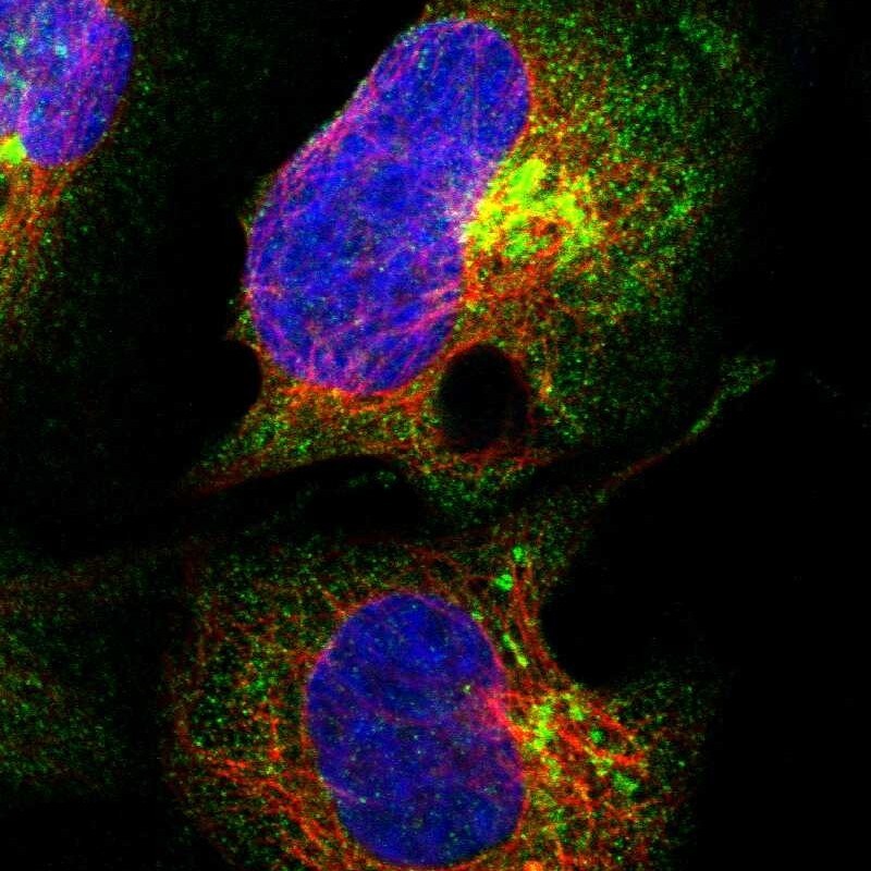 ANKRD40 Antibody - BSA Free Immunocytochemistry/ Immunofluorescence: ANKRD40 Antibody [NBP1-93515]