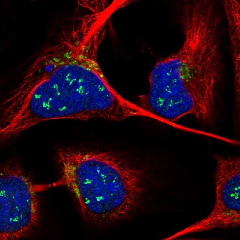 ANKRD40 Antibody - BSA Free Immunocytochemistry/ Immunofluorescence: ANKRD40 Antibody [NBP1-93516]