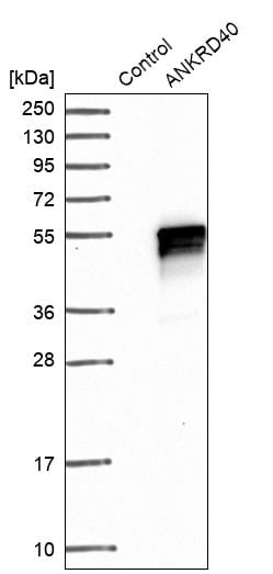 ANKRD40 Antibody - BSA Free Western Blot: ANKRD40 Antibody - BSA Free [NBP1-93516]
