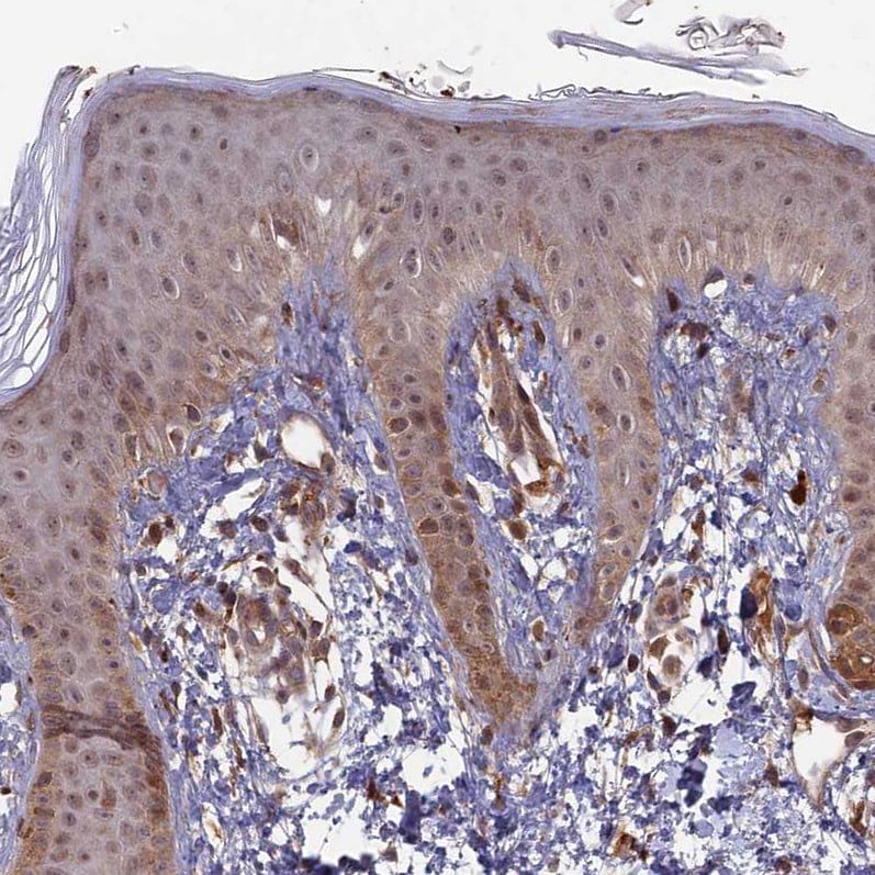 RCCD1 Antibody - BSA Free Immunohistochemistry-Paraffin: RCCD1 Antibody [NBP1-93518]