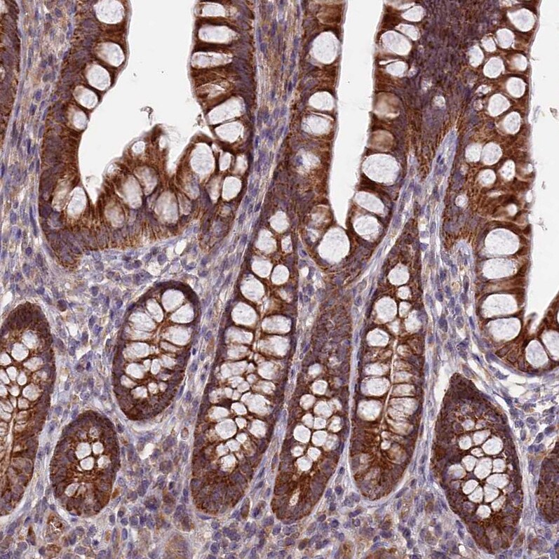 RCCD1 Antibody - BSA Free Immunohistochemistry-Paraffin: RCCD1 Antibody [NBP1-93518]
