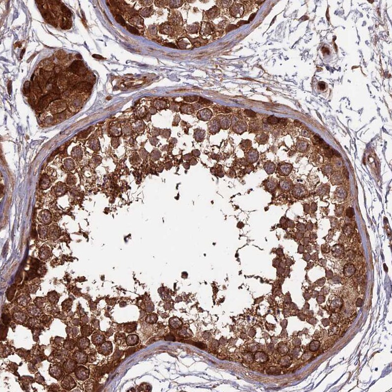 RCCD1 Antibody - BSA Free Immunohistochemistry-Paraffin: RCCD1 Antibody [NBP1-93518]