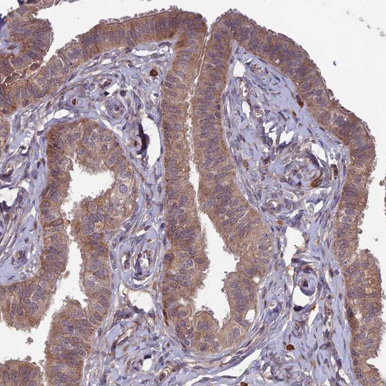RCCD1 Antibody - BSA Free Immunohistochemistry-Paraffin: RCCD1 Antibody [NBP1-93518]