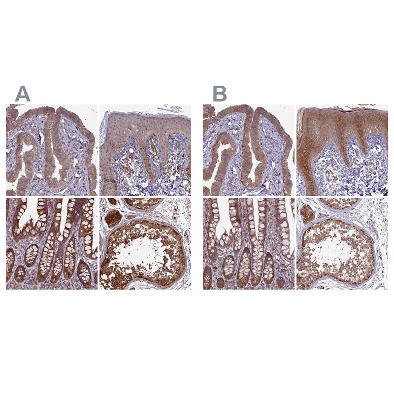 RCCD1 Antibody - BSA Free Immunohistochemistry-Paraffin: RCCD1 Antibody [NBP1-93518]