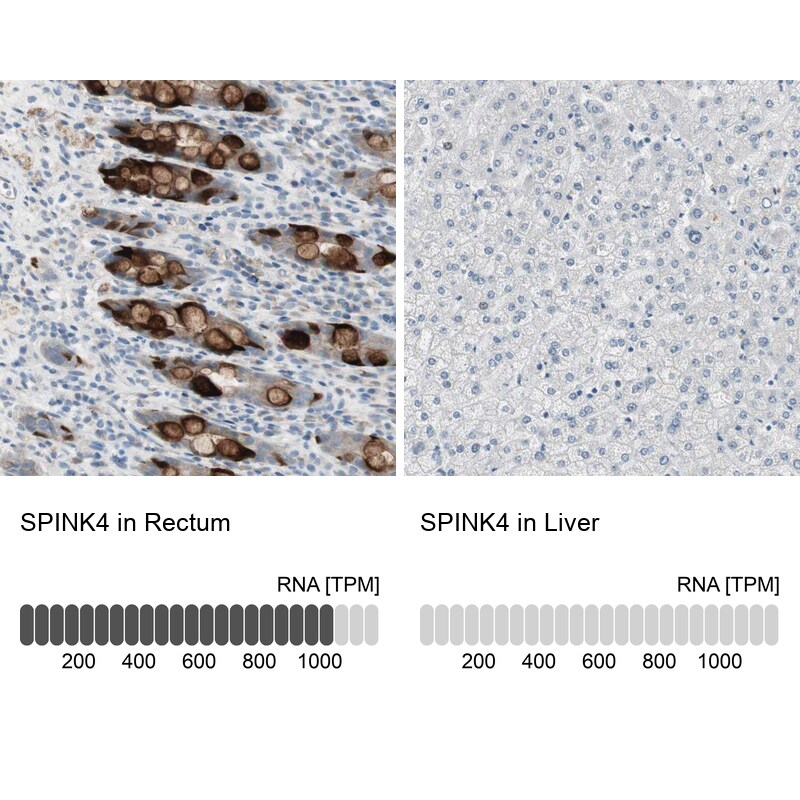 SPINK4 Antibody - BSA Free Immunohistochemistry: SPINK4 Antibody - BSA Free [NBP1-93519]
