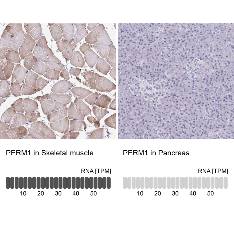 PERM1 Antibody - BSA Free Immunohistochemistry: PERM1 Antibody - BSA Free [NBP1-93520]