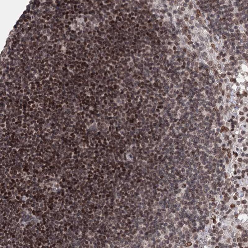 CCDC77 Antibody - BSA Free Immunohistochemistry: CCDC77 Antibody - BSA Free [NBP1-93521]