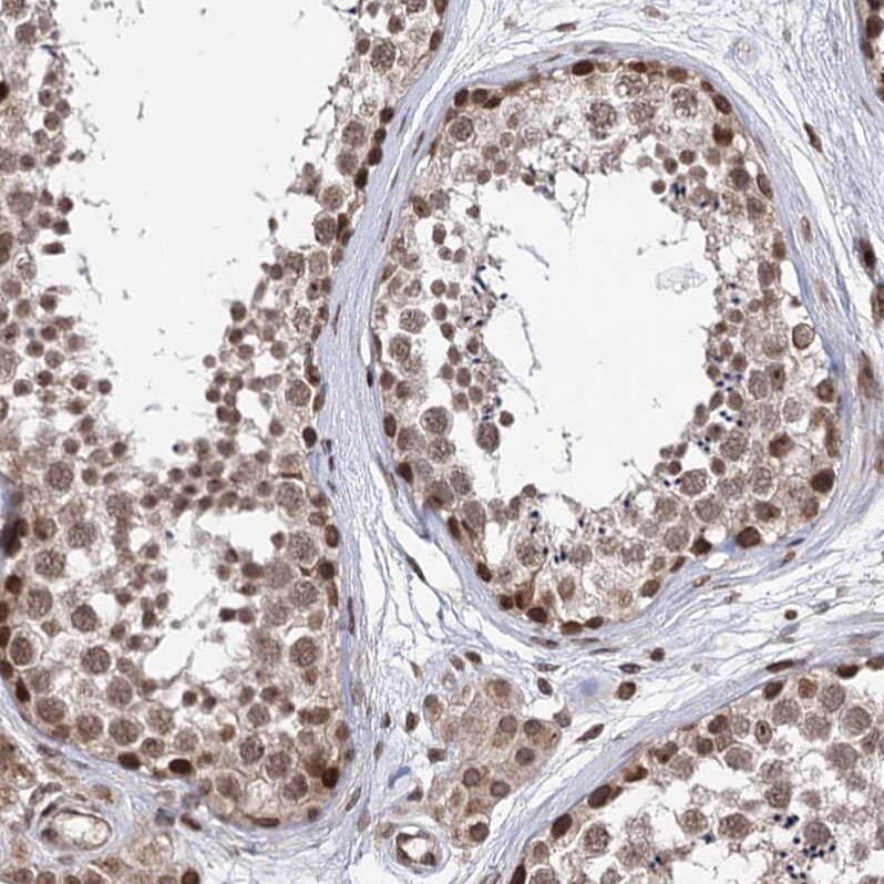 CCDC77 Antibody - BSA Free Immunohistochemistry: CCDC77 Antibody - BSA Free [NBP1-93521]