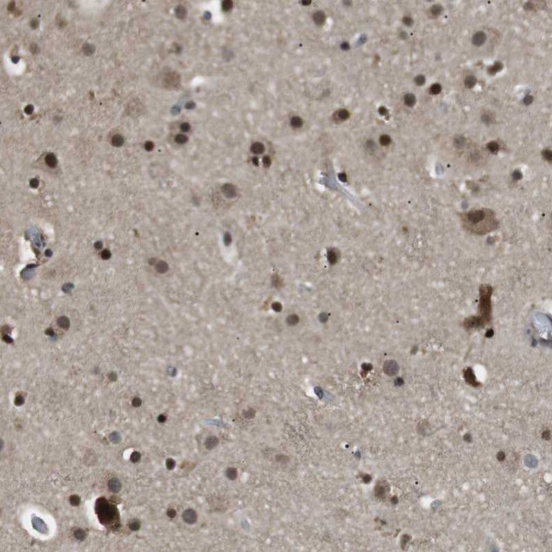 ORAI3 Antibody - BSA Free Immunohistochemistry: ORAI3 Antibody - BSA Free [NBP1-93523]