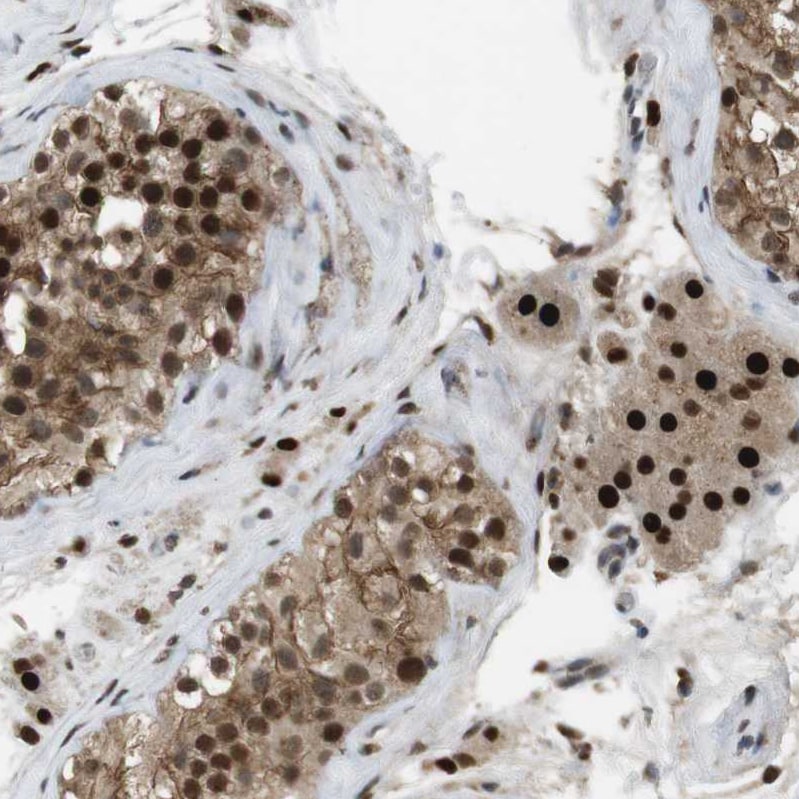 ORAI3 Antibody - BSA Free Immunohistochemistry: ORAI3 Antibody - BSA Free [NBP1-93523]