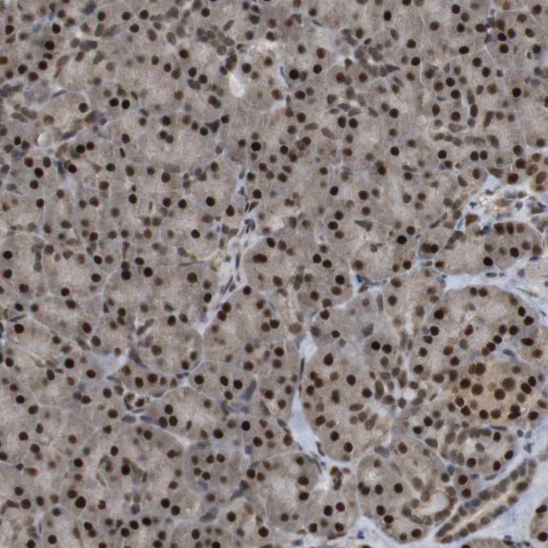 ORAI3 Antibody - BSA Free Immunohistochemistry: ORAI3 Antibody - BSA Free [NBP1-93523]