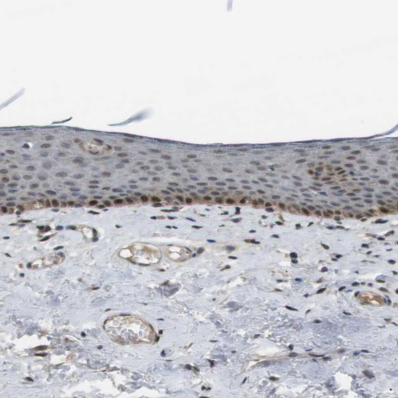 ORAI3 Antibody - BSA Free Immunohistochemistry: ORAI3 Antibody - BSA Free [NBP1-93523]