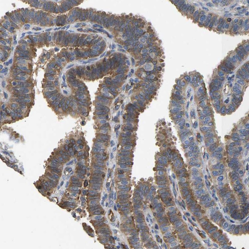 METTL21D Antibody - BSA Free Immunohistochemistry: METTL21D Antibody - BSA Free [NBP1-93526]