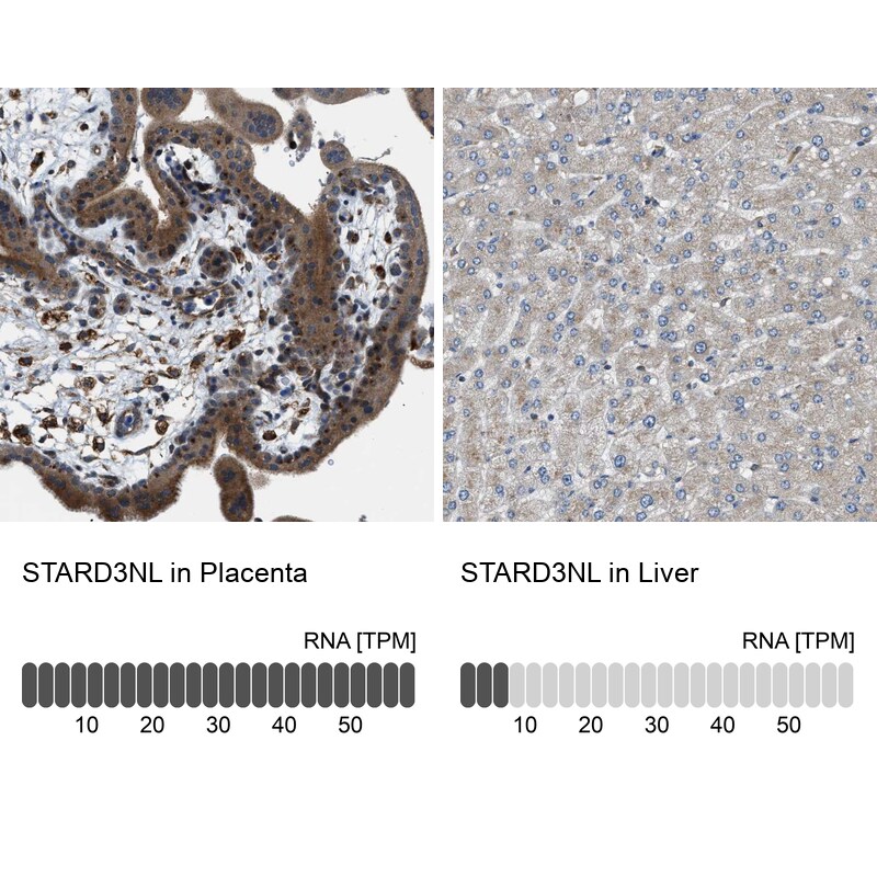 STARD3NL Antibody - BSA Free Immunohistochemistry: STARD3NL Antibody - BSA Free [NBP1-93527]