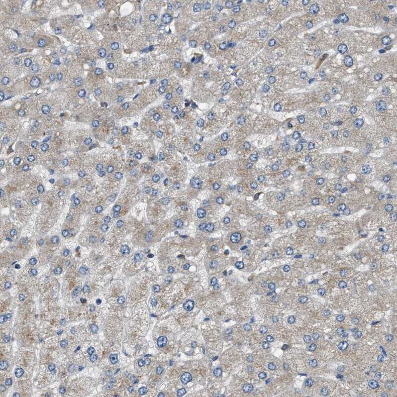 STARD3NL Antibody - BSA Free Immunohistochemistry: STARD3NL Antibody - BSA Free [NBP1-93527]