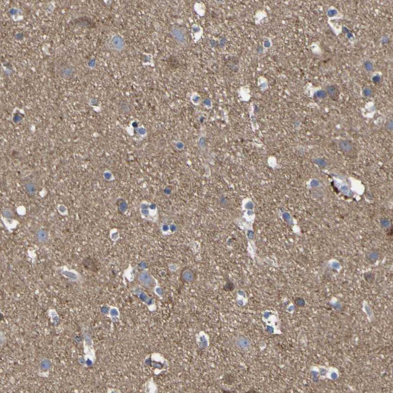 CCDC90B Antibody - BSA Free Immunohistochemistry: CCDC90B Antibody - BSA Free [NBP1-93528]