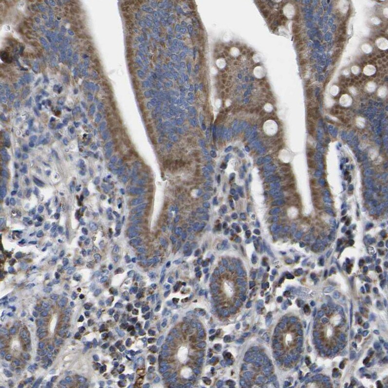 CCDC90B Antibody - BSA Free Immunohistochemistry: CCDC90B Antibody - BSA Free [NBP1-93528]