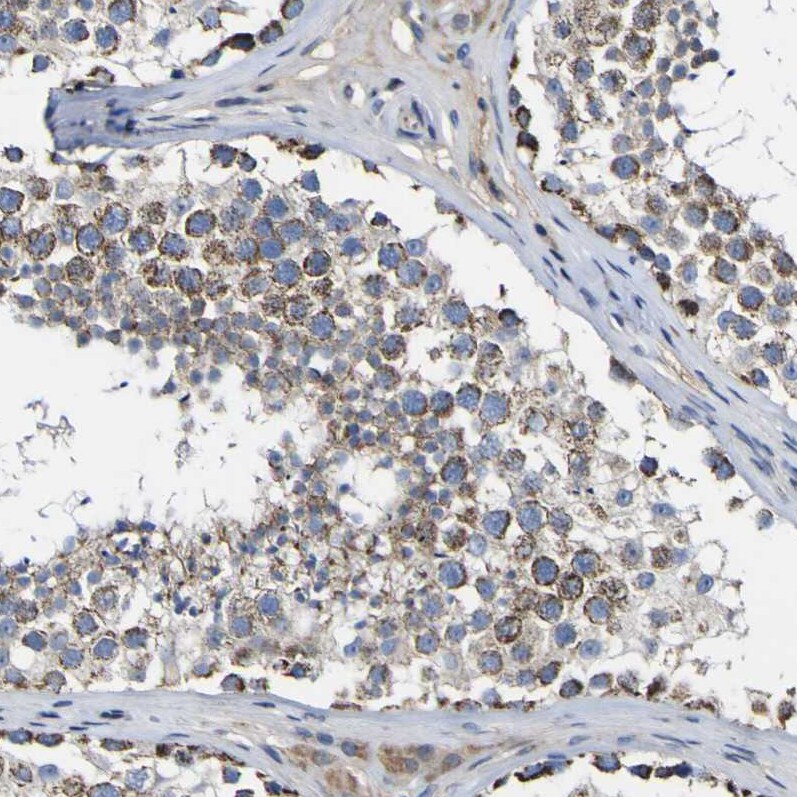 CCDC90B Antibody - BSA Free Immunohistochemistry: CCDC90B Antibody - BSA Free [NBP1-93528]