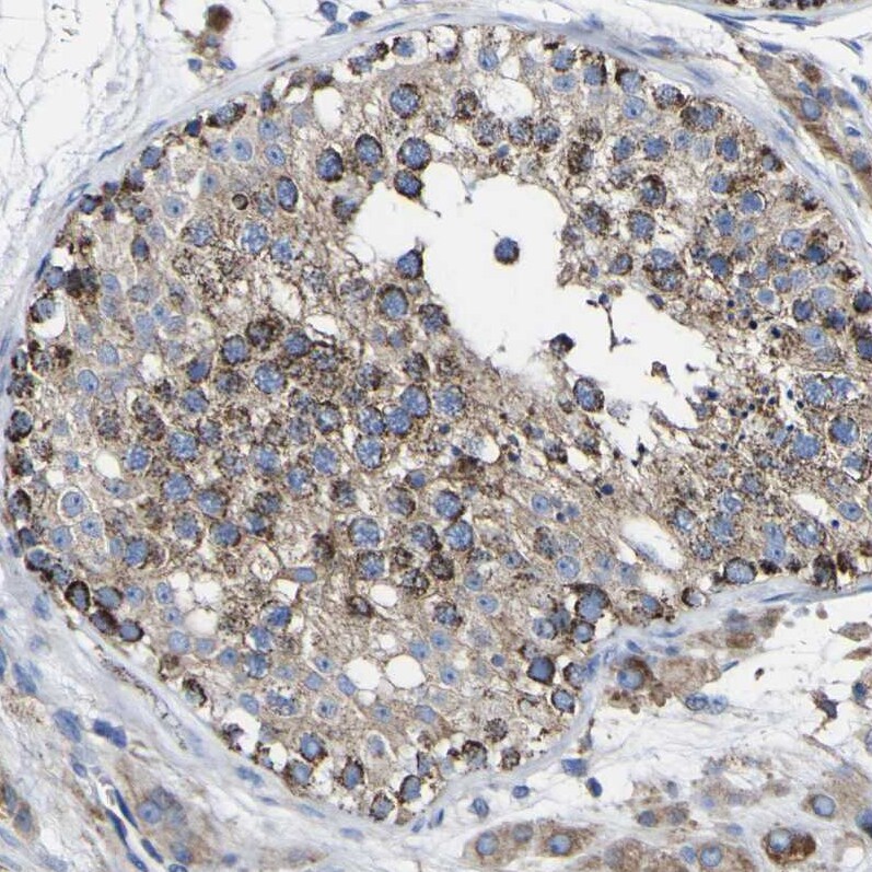 CCDC90B Antibody - BSA Free Immunohistochemistry: CCDC90B Antibody - BSA Free [NBP1-93529]
