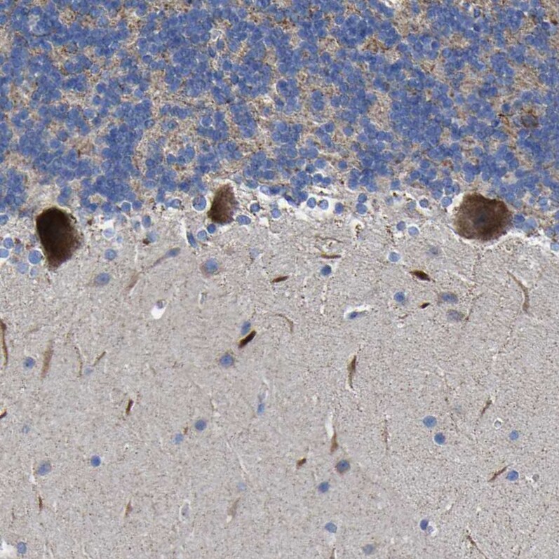 CCDC90B Antibody - BSA Free Immunohistochemistry: CCDC90B Antibody - BSA Free [NBP1-93529]